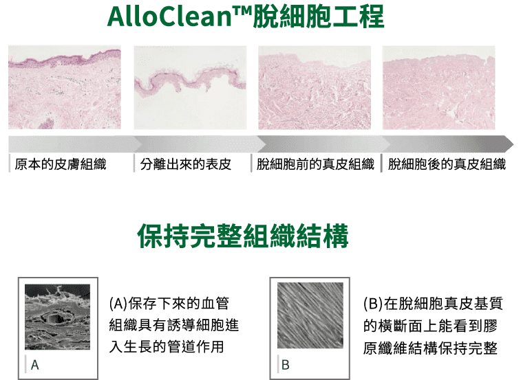 使用AlloClean™技術加工的人體皮膚。 Alloclean™工藝可滅活或清除細胞碎片，抗原和潛在病毒，同時保持 預處理膠原蛋白固有的結構完整性