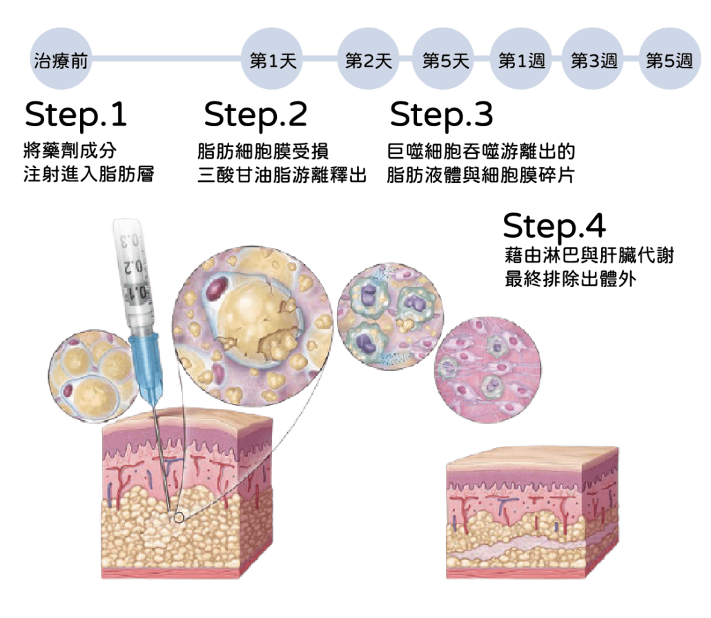 消脂針皮下減脂細胞變化
