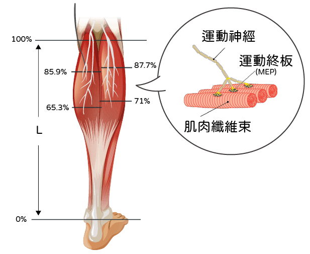 肉毒小腿施打於腓腸肌神經最密集部位