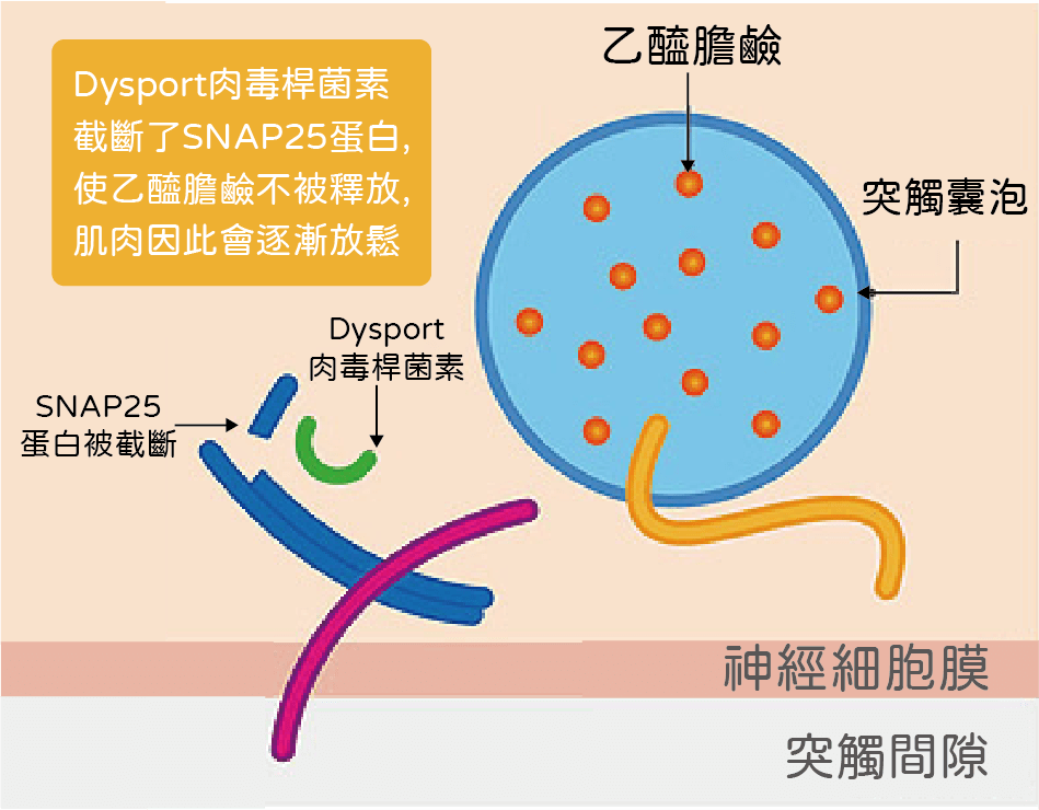 dysport皇家肉毒-肉毒桿菌作用機制
