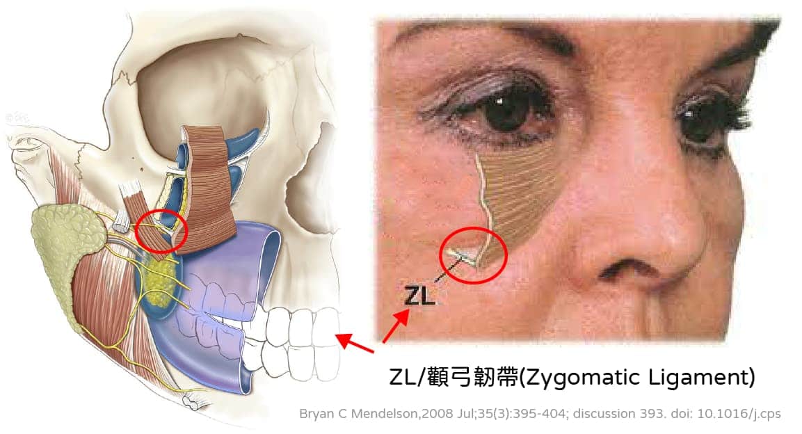 印地安紋顴骨弓韌帶位置Zygomatic ligament