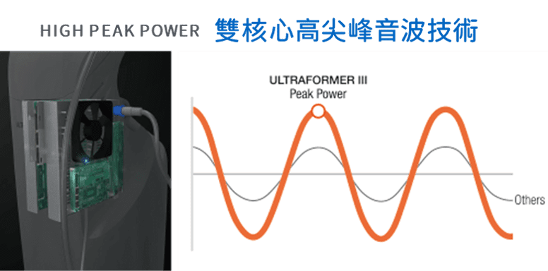 Ultrafomer海芙音波-雙核⼼⾼尖峰⾳波技術