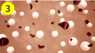 洢蓮絲PCL晶球啟動免疫機制