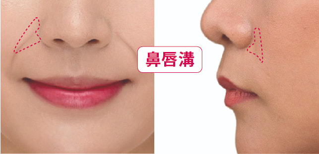 鼻唇溝構造